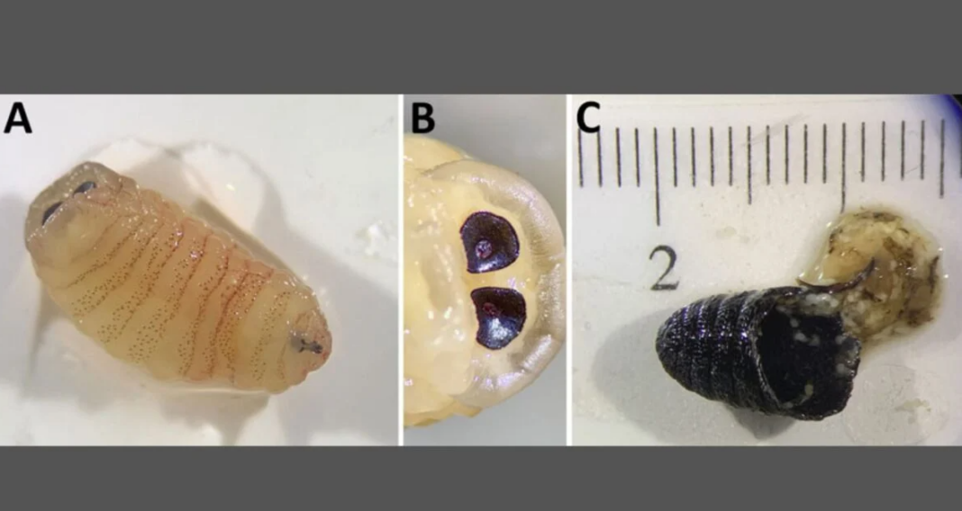 Greek Woman Sneezes Worms