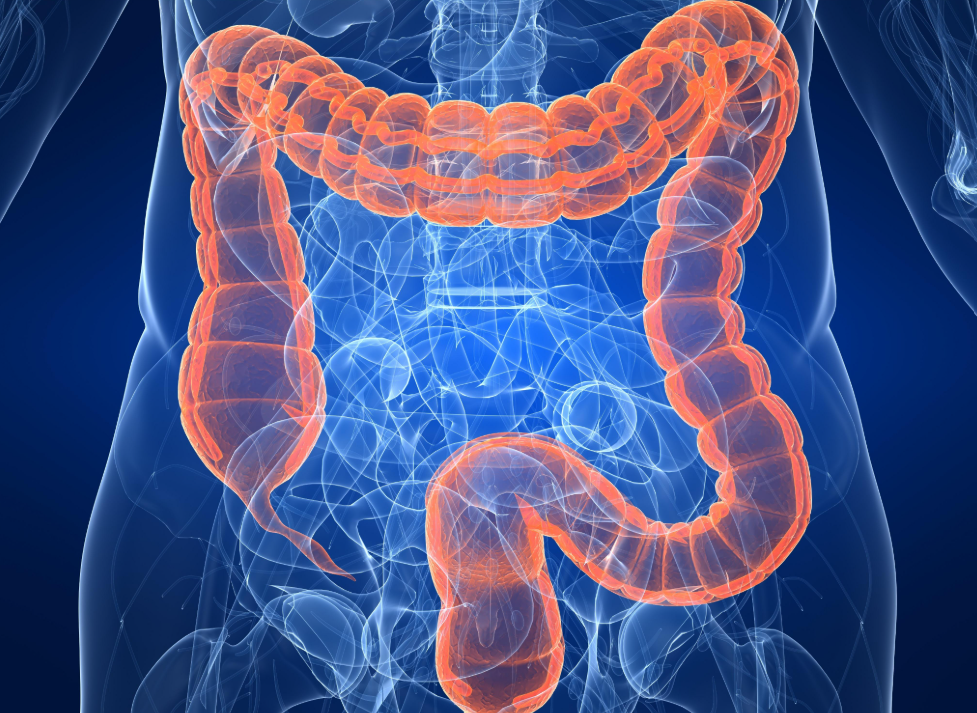 Colorectal Cancer Study