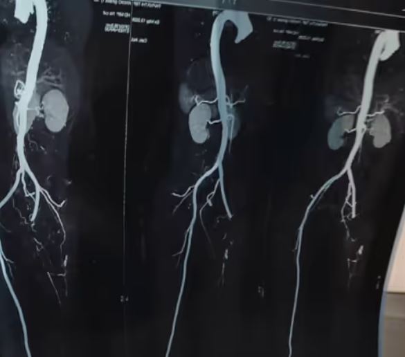 Alleged Medical Negligence