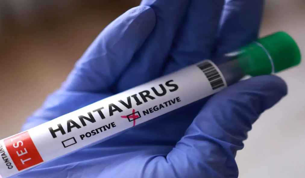 Hantavirus