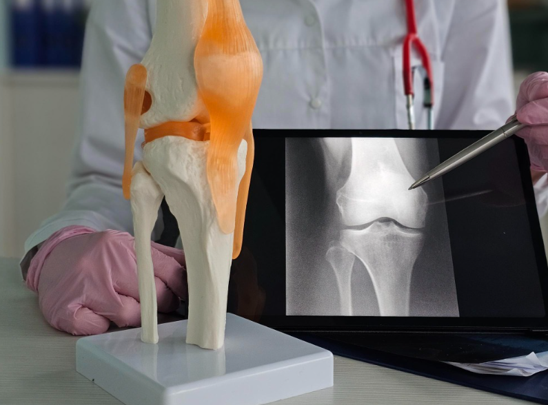 Rare Bone Cancer Recovery
