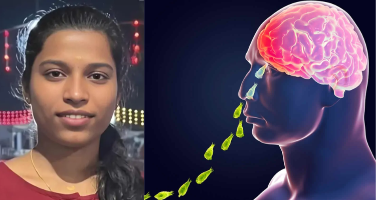 Amoebic Meningoencephalitis Kerala