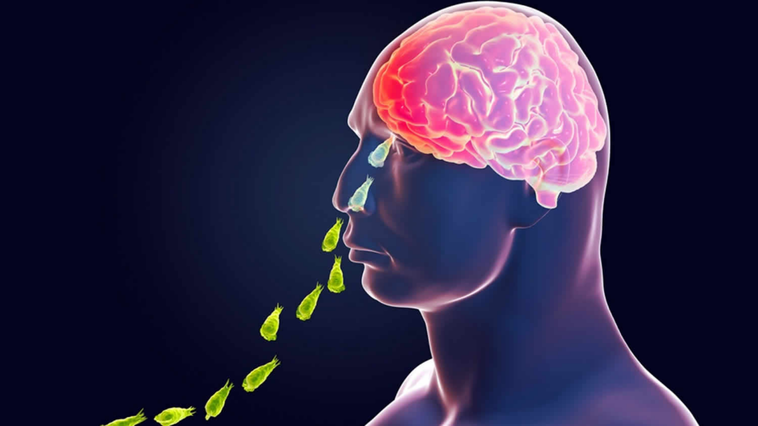 Amoebic Meningoencephalitis Kerala