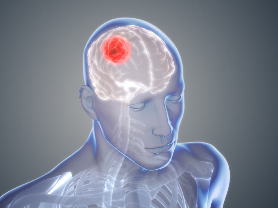 World Brain Tumor Day