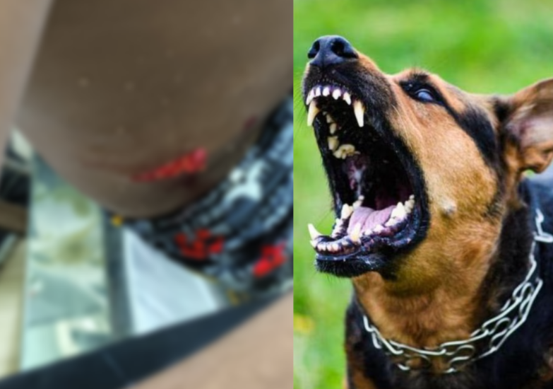 Kondotty Dog Attack