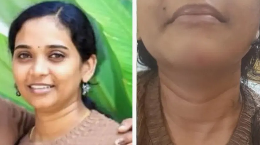 Thiruvananthapuram Attukal suicide