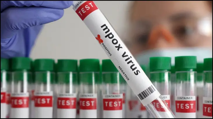 US scientists booked FBI Mpox virus smuggling
