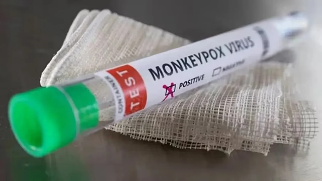 Monkeypox Mpox confirmed case Thiruvananthapuram Kerala