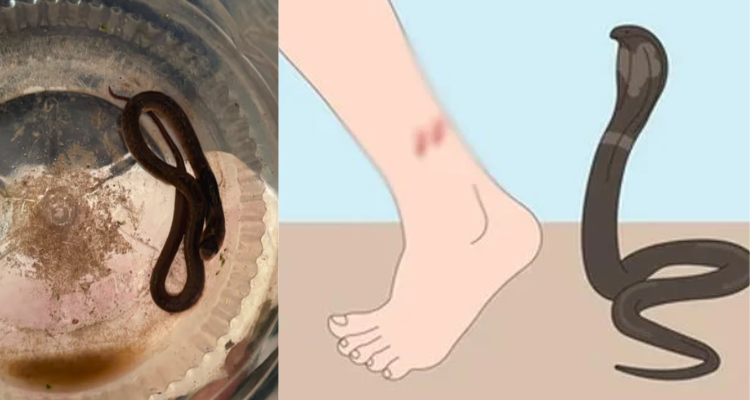 Eranhipalam snake bite incident