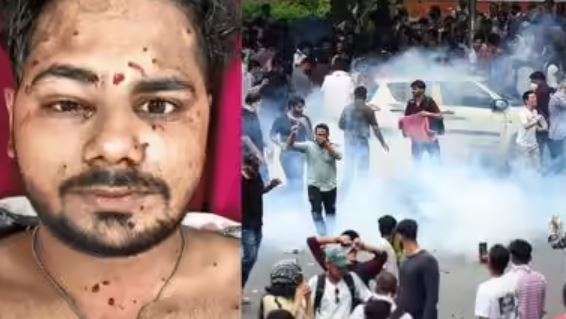 Delhi Student Protest Pellet Gun