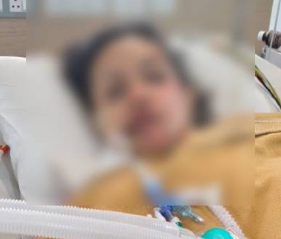 Bengaluru bike taxi accident