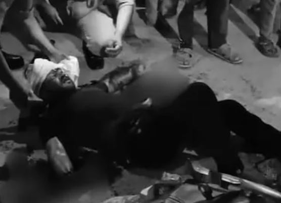 Man's Hands Chopped Off