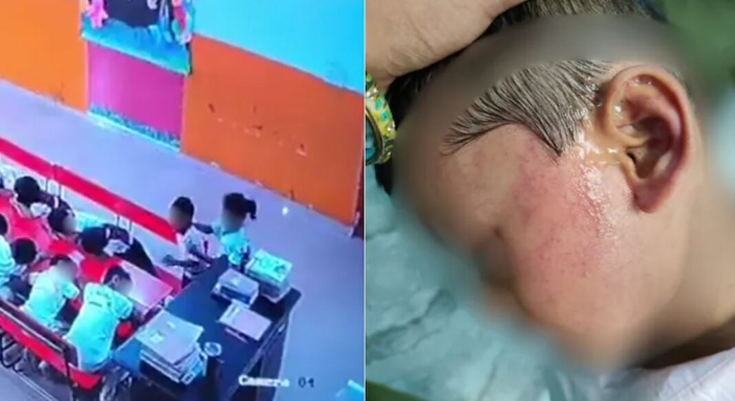 Nursery Student Brutally Beaten