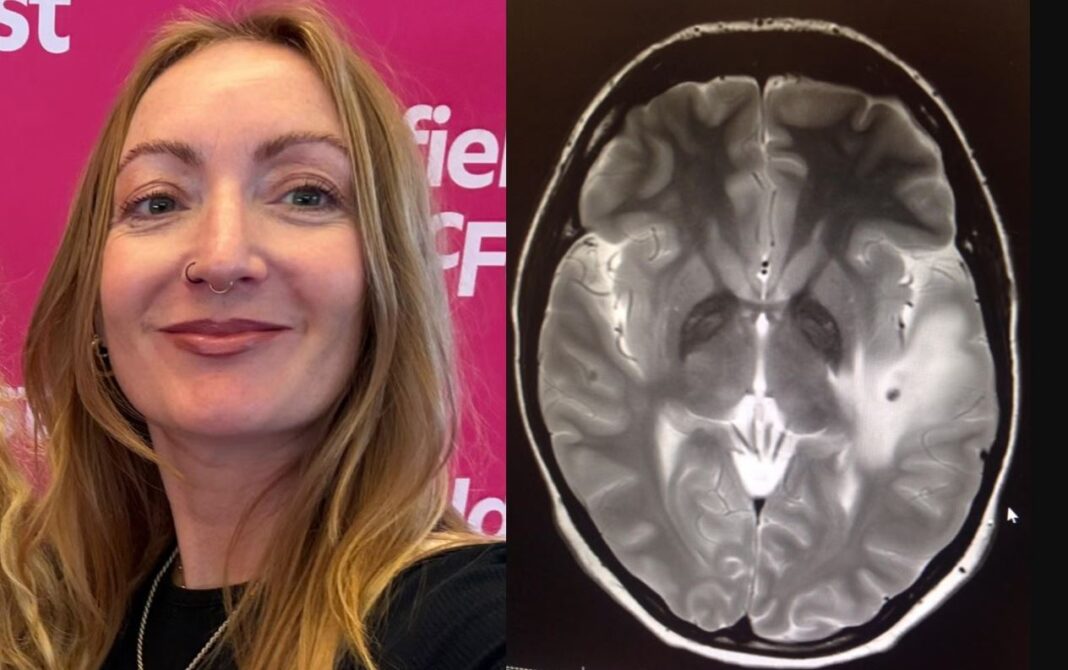 Lowri Denman Tapeworm Brain UK