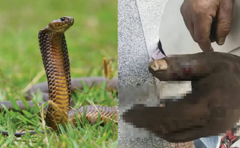 snake bite